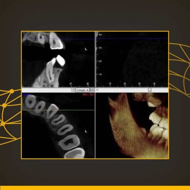 Tomografia odontológica preço – RadioCenter Curitiba