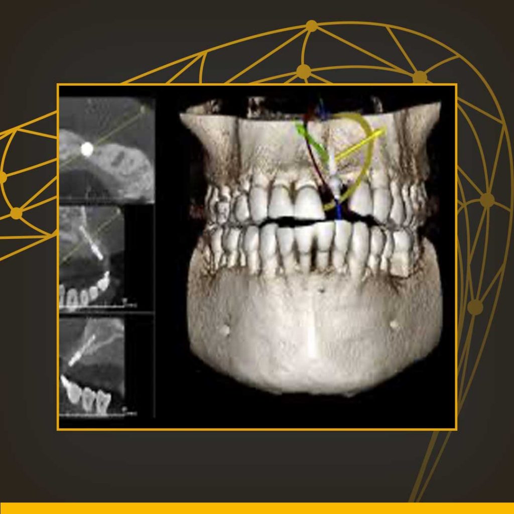 Preço de Exame odontológico tomografia realizada em Curitiba