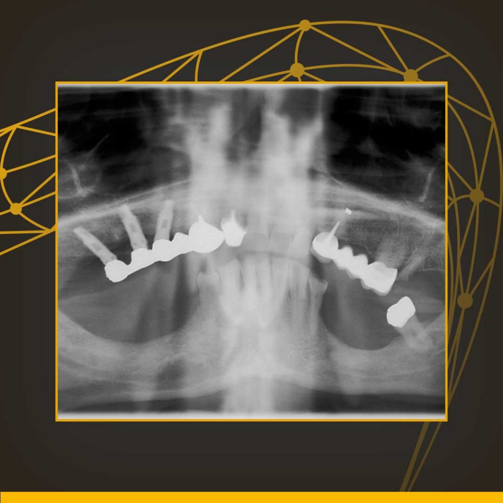Exame Odontológico de radiografia panorâmica