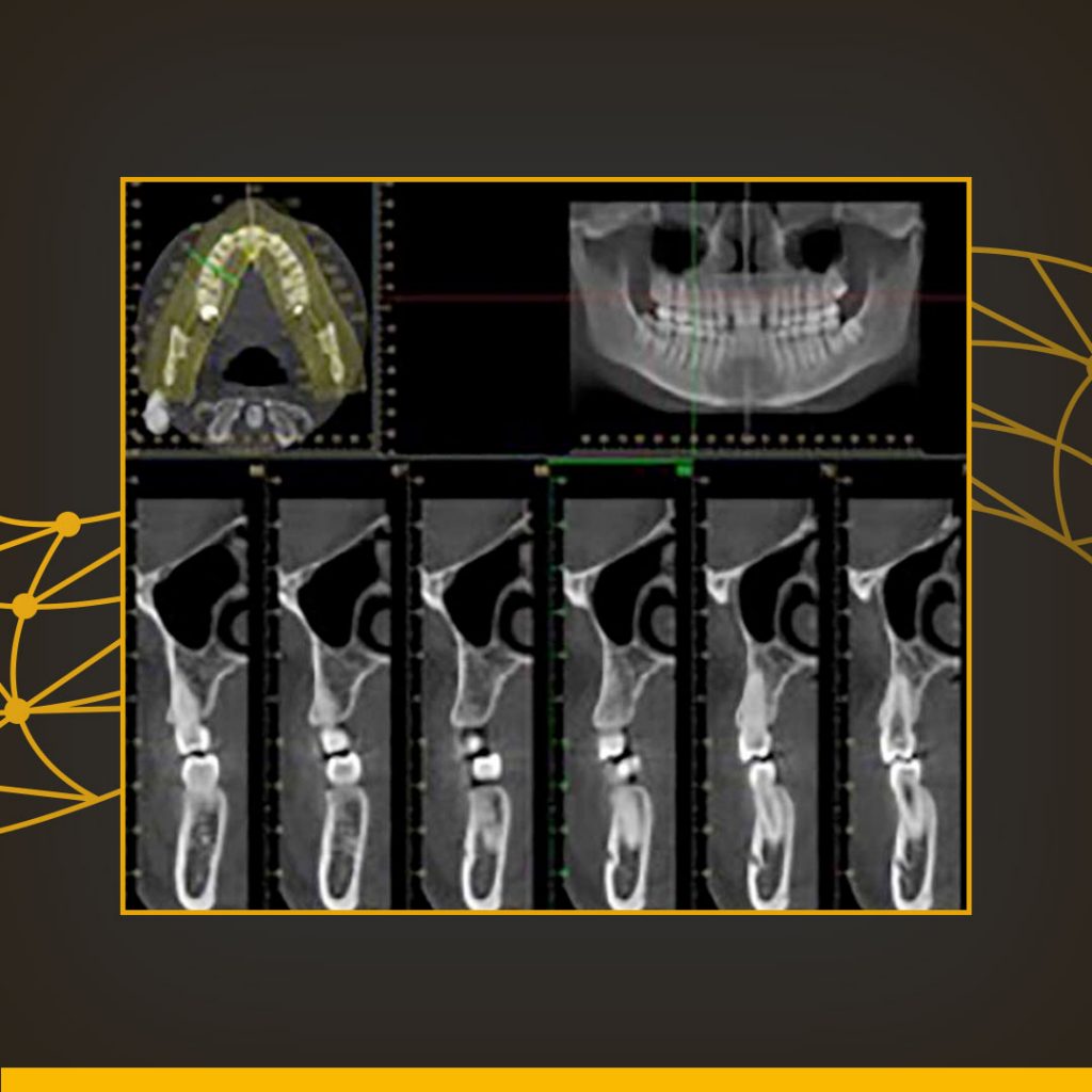 Radiologia Odontologica 2