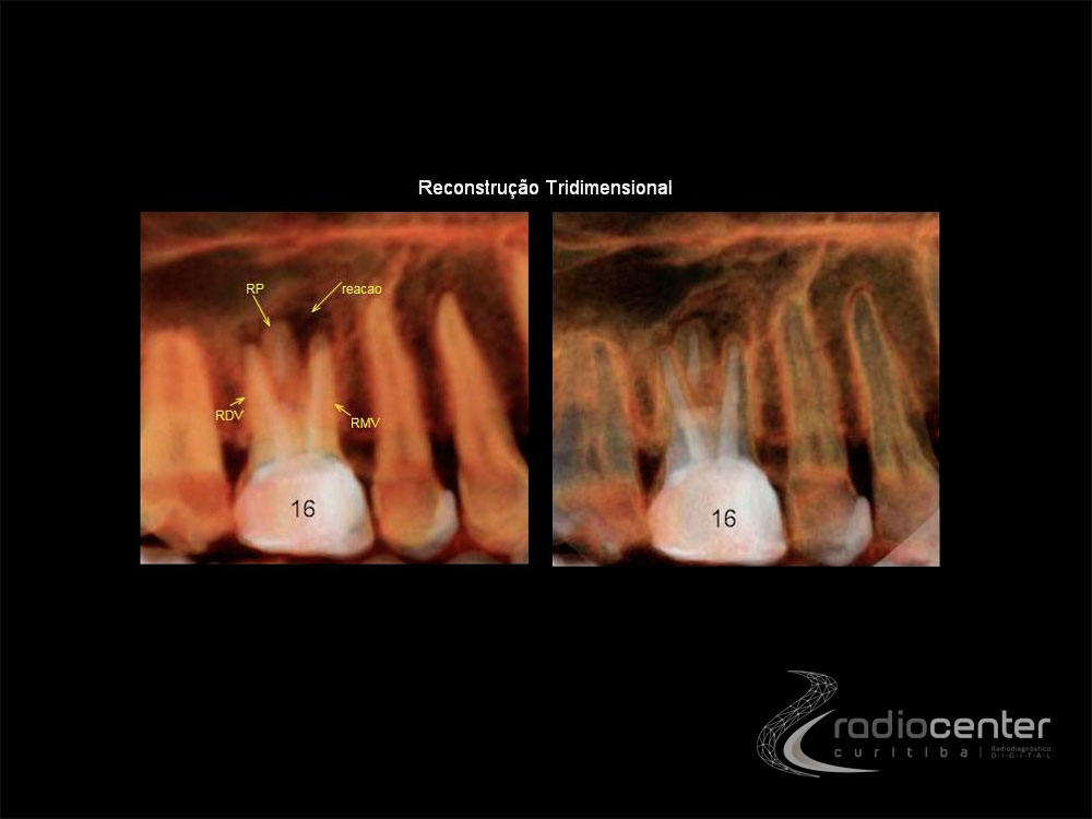 Exame odontologico endodontia