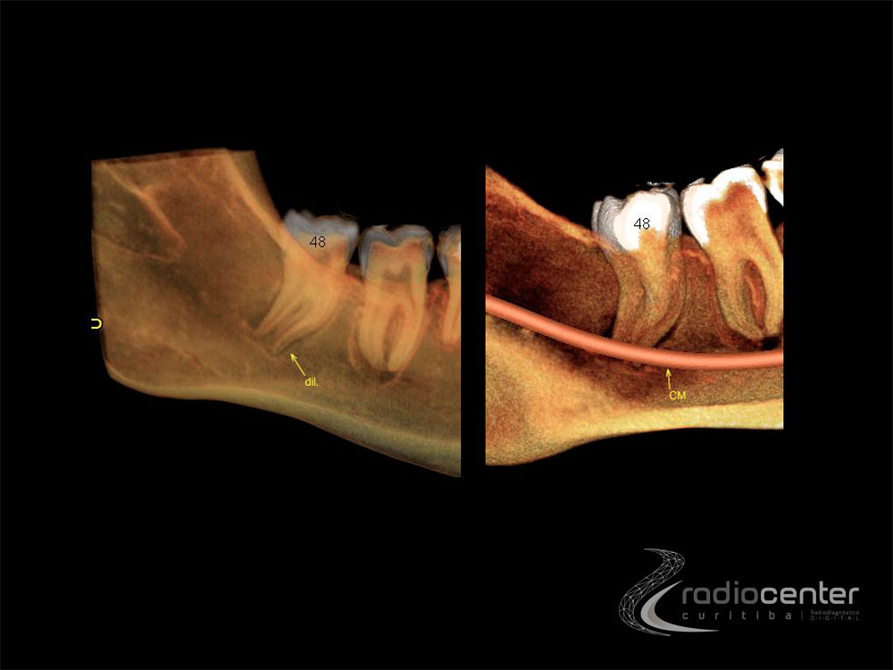 Exames odontologicos para implantodontia