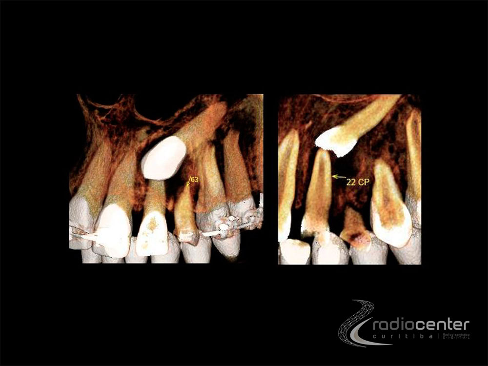 Exames odontológicos para Ortodontia
